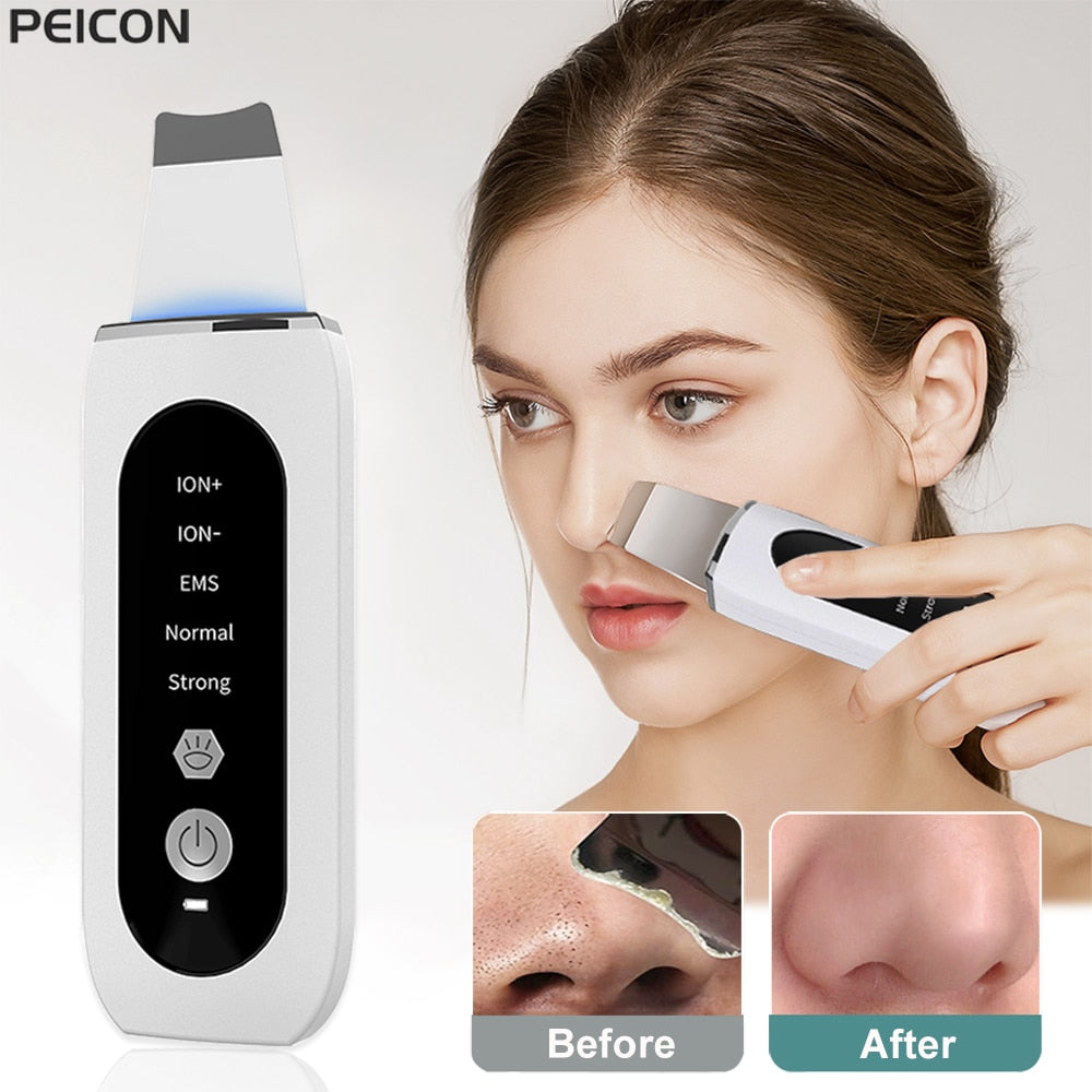 GlowWave Ultrasonic Skin Scrubber